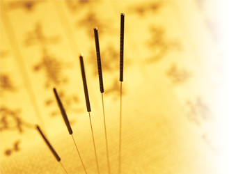 Photo of acupuncture needles