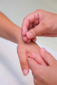 acupuncture hand demonstration