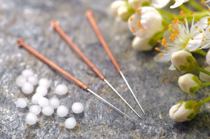 5 Myths about Acupuncture-2-784456-edited