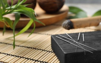 5 Surprising Things New Research is Revealing About Acupuncture