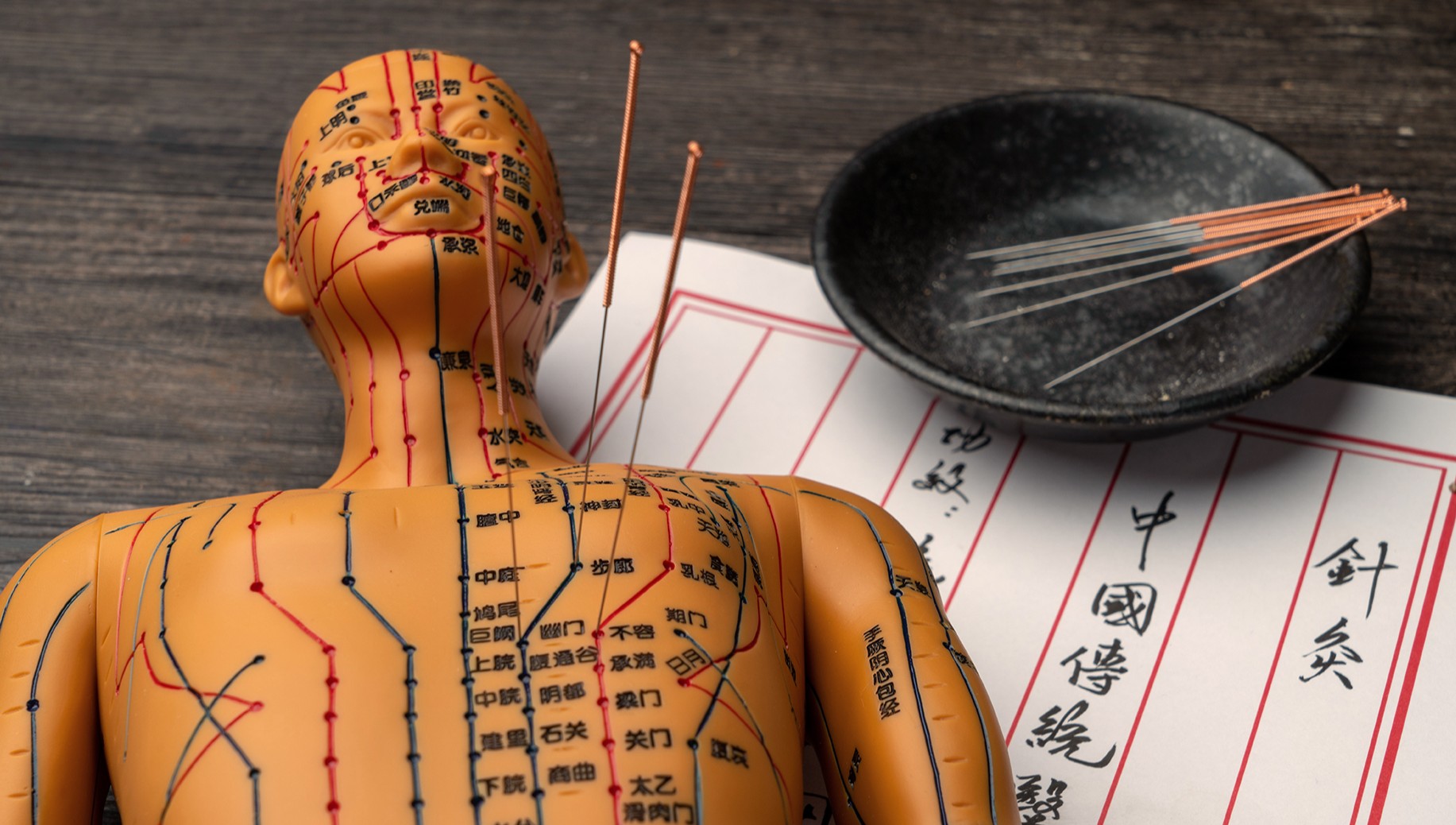 acupuncture points, needles and TCM scroll