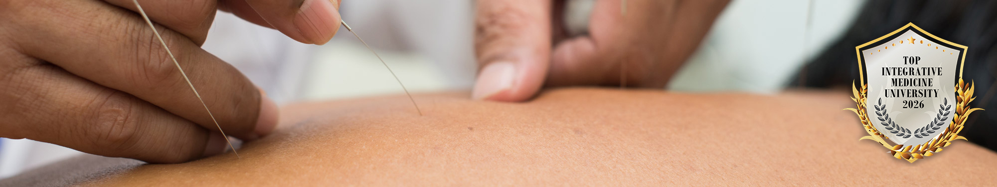 doctor performing acupuncture on patient's back
