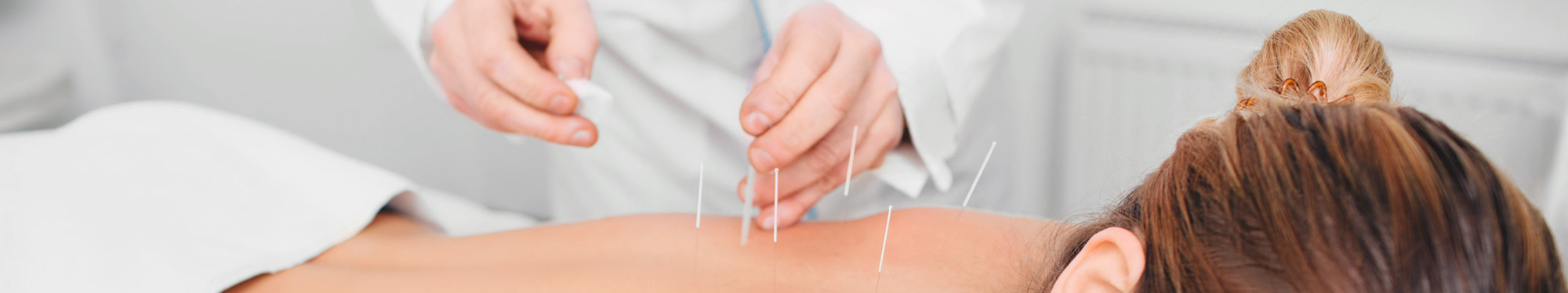 doctor of acupuncture inserting a needle into a female back