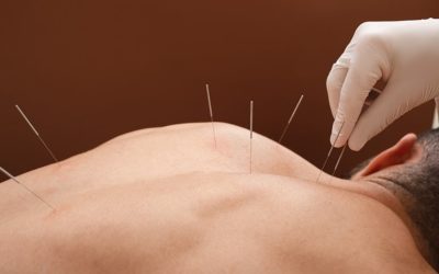 The Health and Wellbeing Benefits of Acupuncture