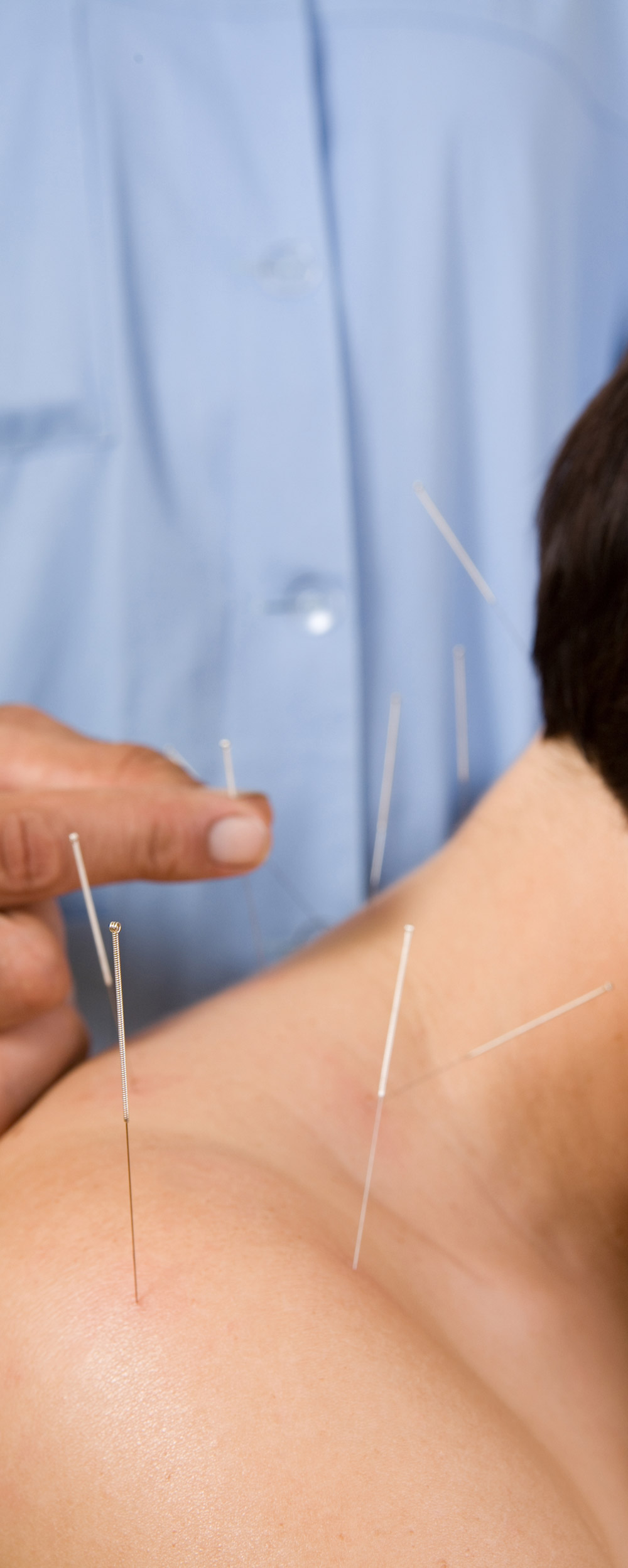 doctor of acupuncture working on woman's neck