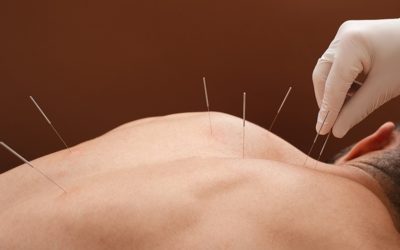 Why the future of acupuncture is promising